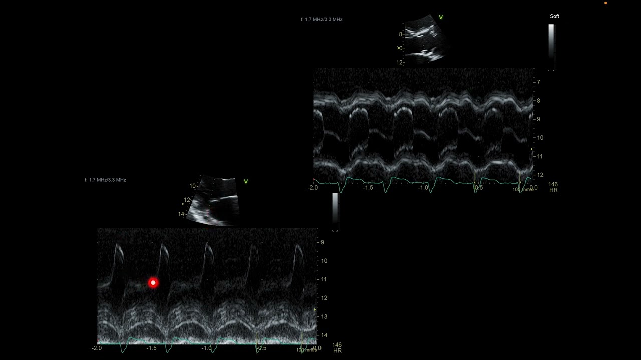 M-mode imaging
