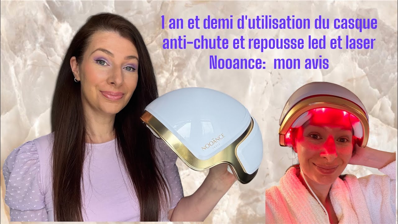 1 an et demi d'utilisation du casque cheveux anti chute et repousse led et laser Nooance: mon avis!
