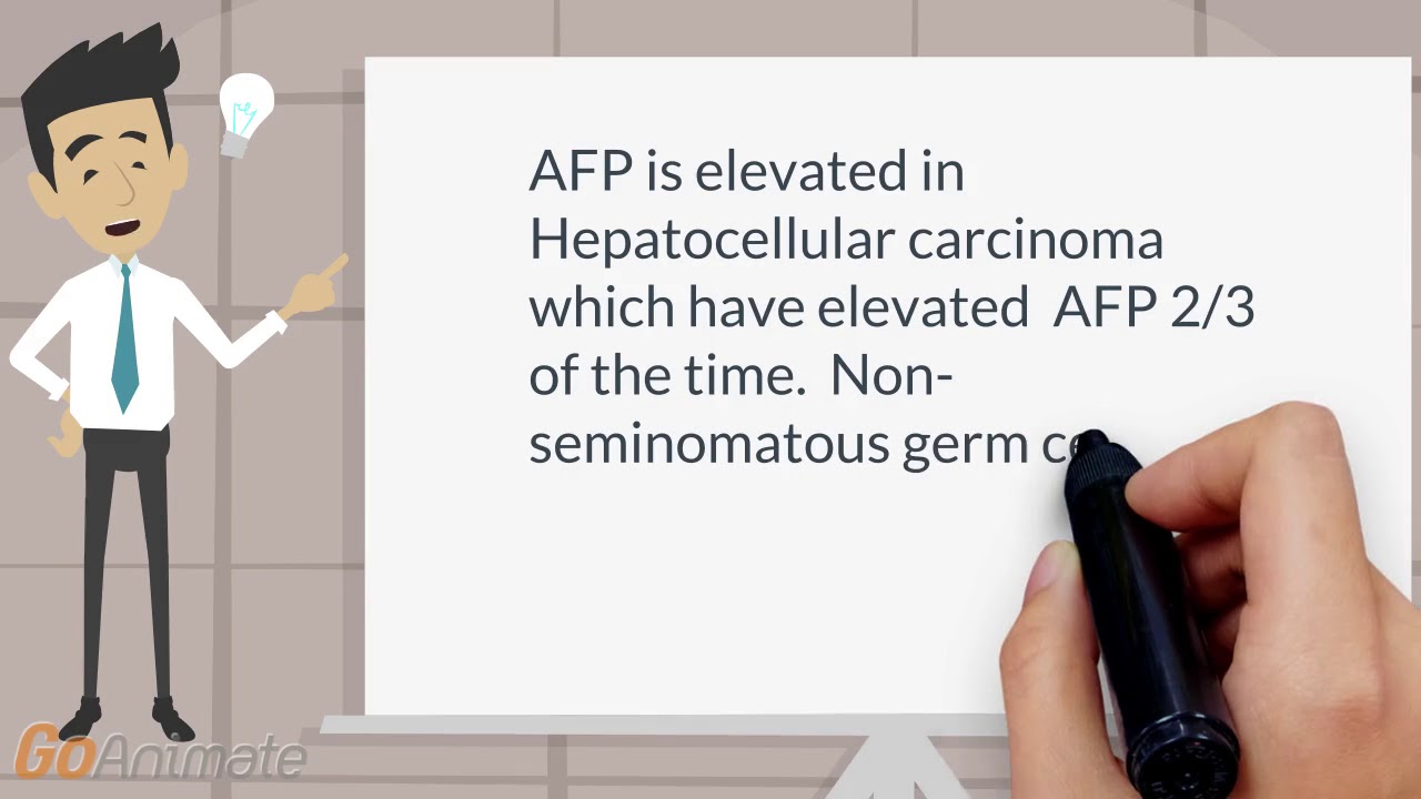 Elevated alfafetoprotein (AFP)