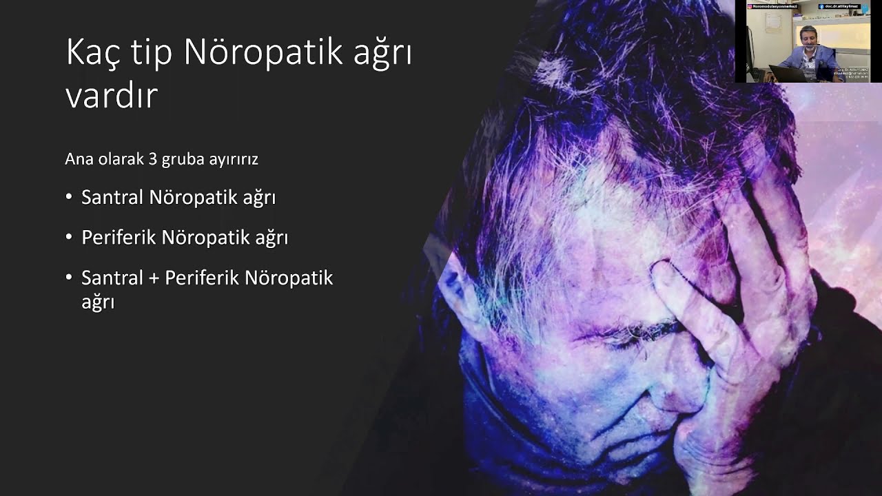 Nöropatik Ağrı, Kronik Ağrı, Dirençli Şiddetli Ağrı, Omurilik Pili tedavisinde Omurilik Pili