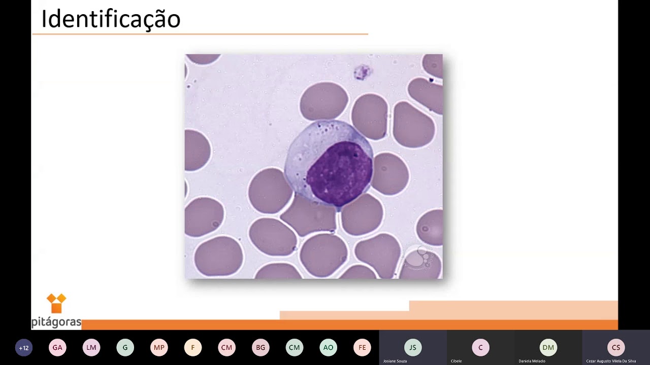 Hematologia - Aula 09: Diferencial de leucócitos, hematoscopia e contagem de reticulócitos
