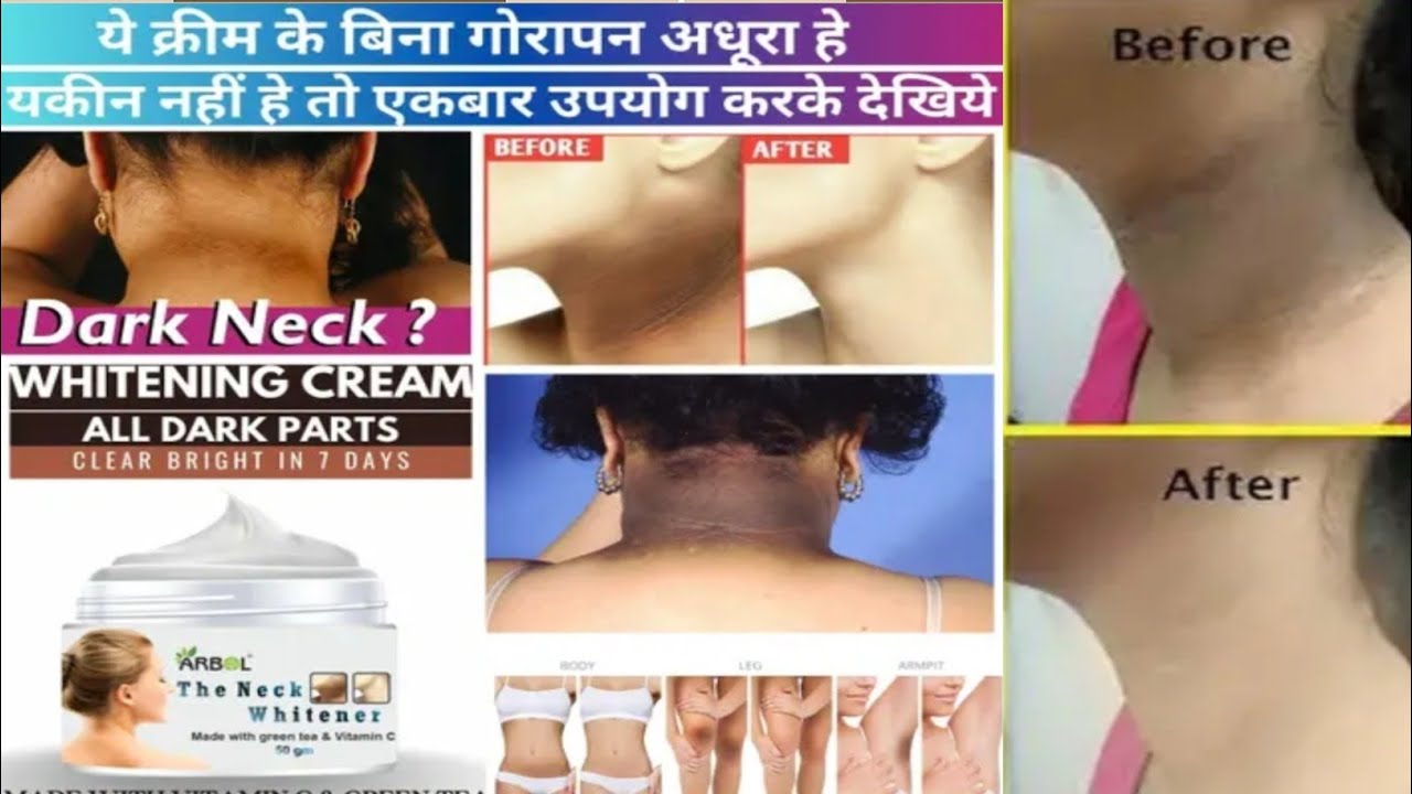 What cream to use for a dark neck? Arbol Review #DarkNeckSolution