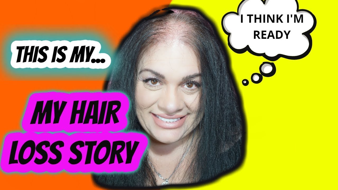 Who's June Penny? My Hair loss Story. Why I have balding hair
