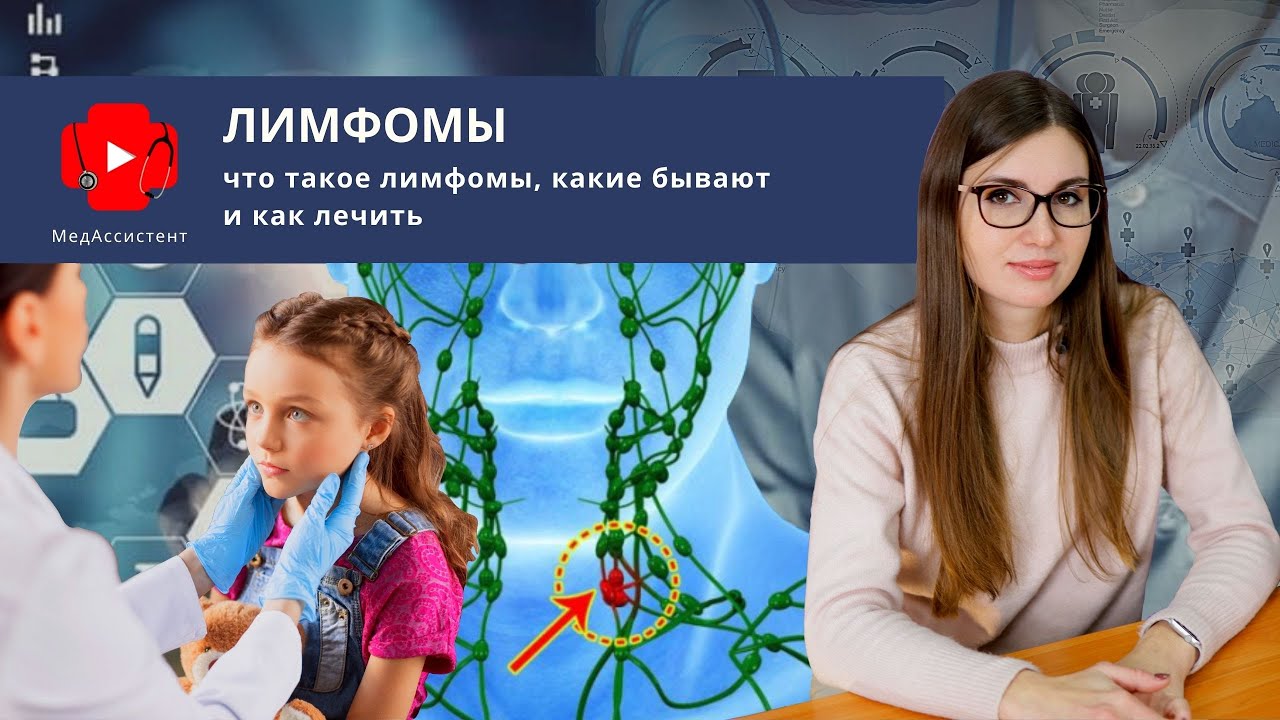 Что такое лимфомы, какие бывают и как лечить