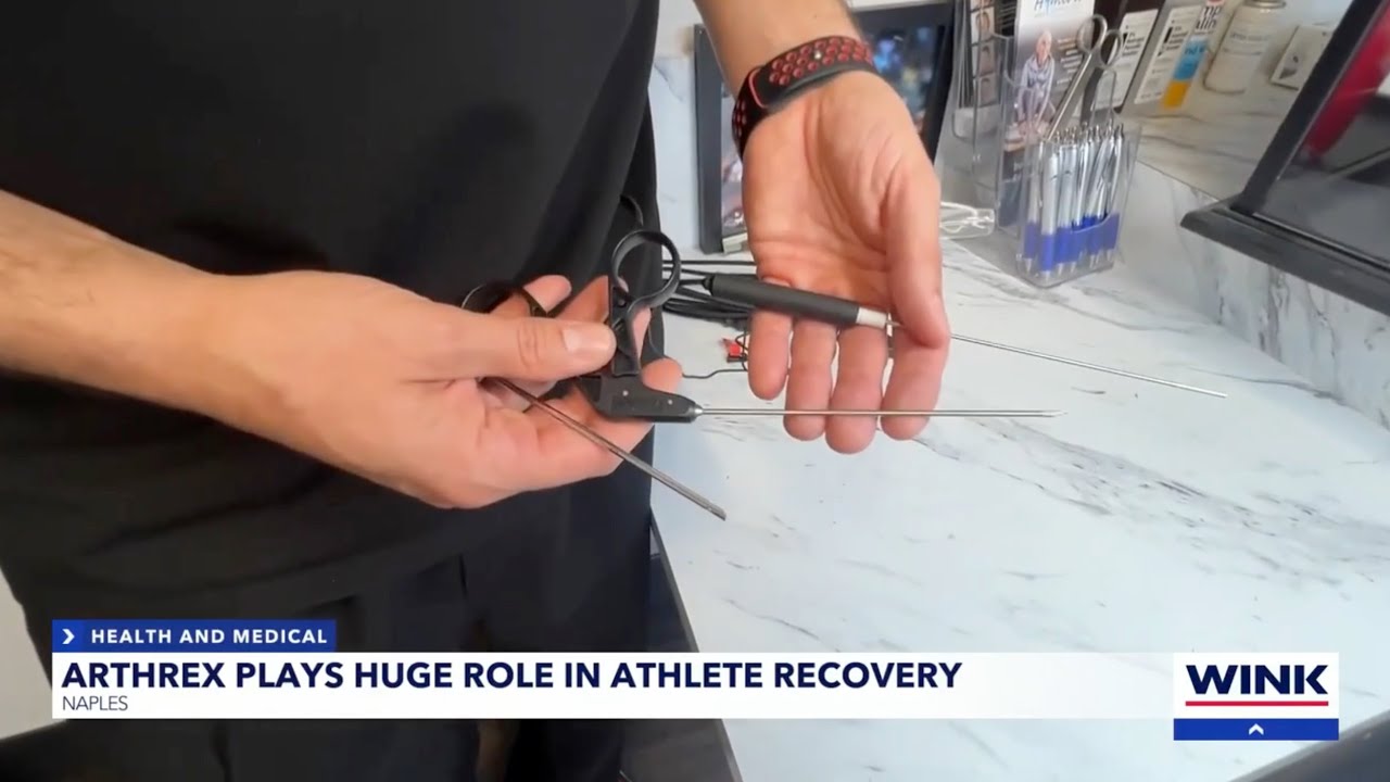 Arthrex innovation featured on CBS affiliate WINK News post-Super Bowl LVIII