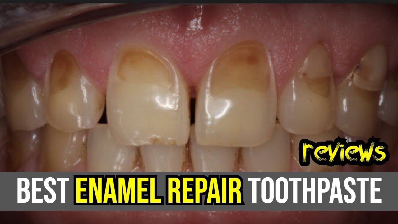 🦷 Best Enamel Repair Toothpaste Review 2024: Sensodyne, Crest, & ARM & Hammer! 🌟