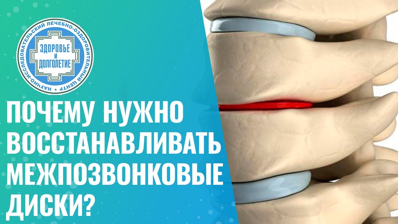 👉 Почему нужно восстанавливать межпозвонковые диски?