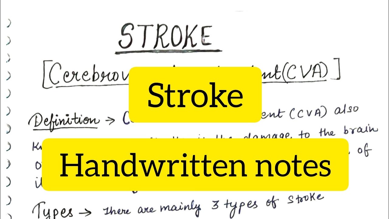 Stroke | CVA | Definition | Signs & Symptoms | Pathophysiology | Management |