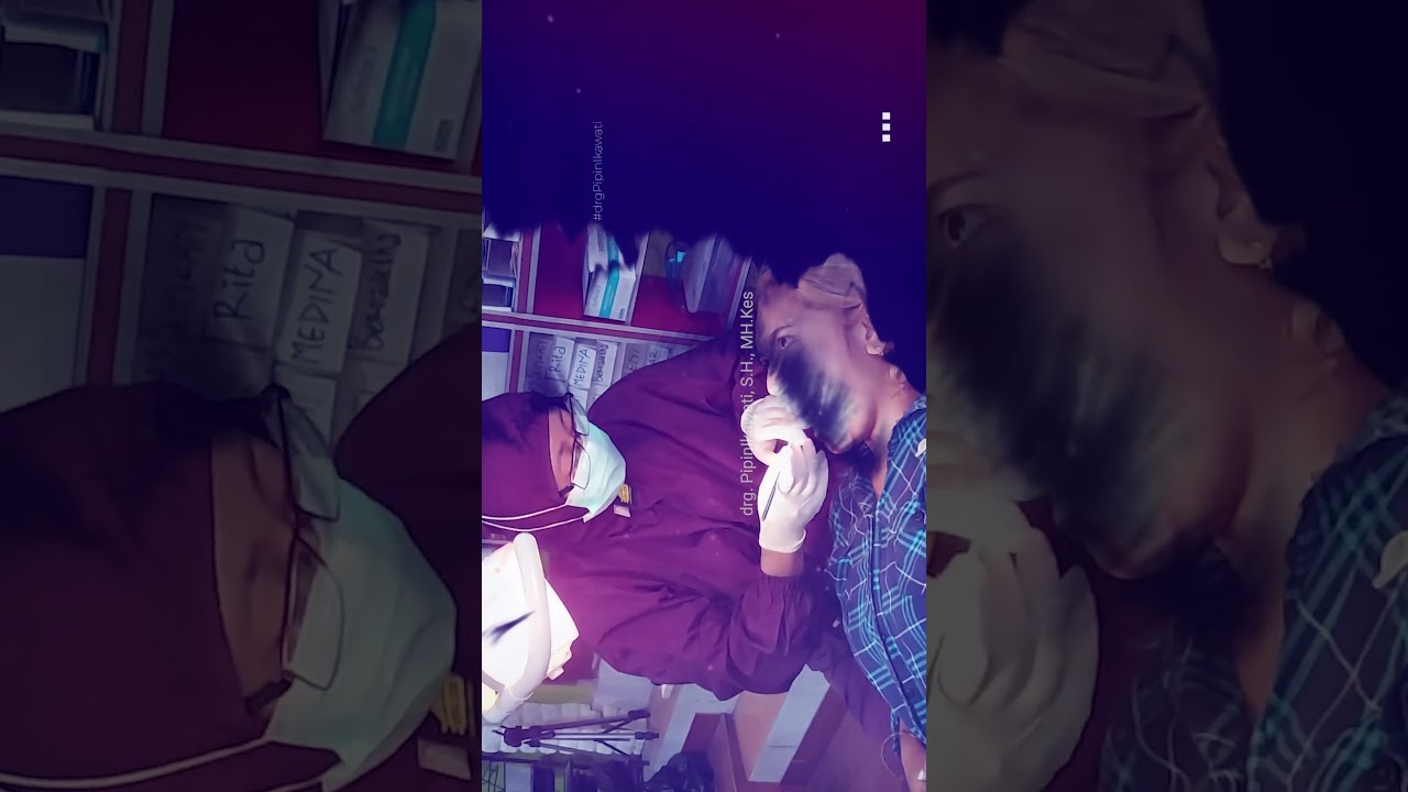 GIGI CAMEH CAKIL BERANTAKAN & KEROPOS SUDAH NORMAL RAPI DLM 12 BULAN PERAWATAN BEHEL || PART 1 OF 4