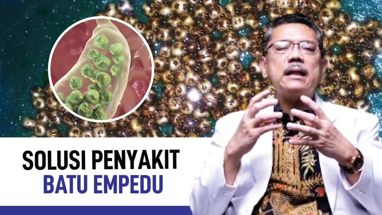 Batu Empedu: Gejala, Penyebab, dan Cara Mengatasi | Kata Dokter