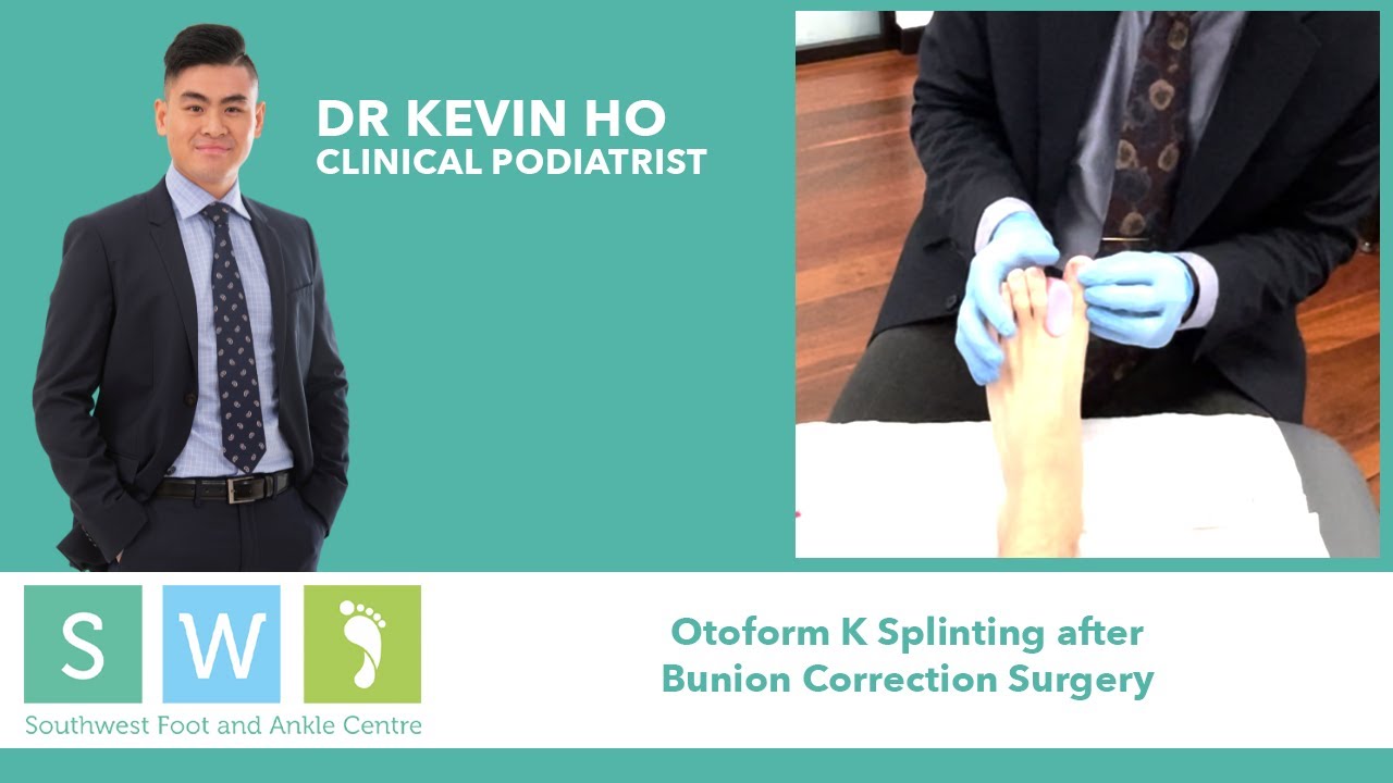 Otoform K Splinting After Bunion Correction Surgery