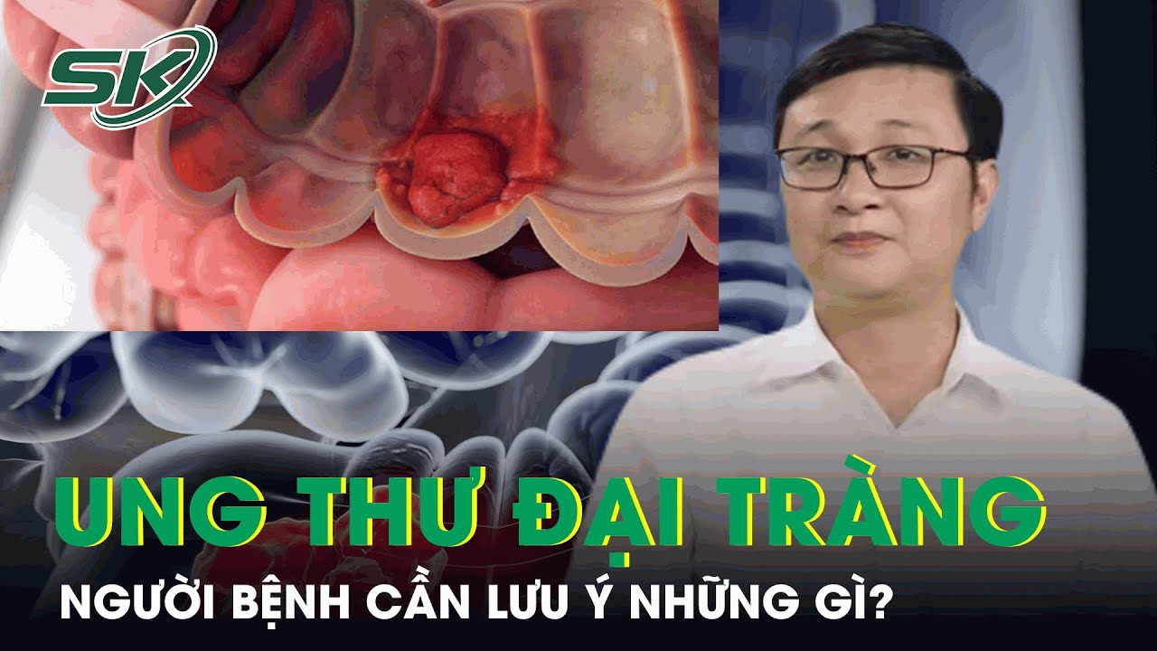 Bệnh Nhân Ung Thư Đại Tràng Cần Lưu Ý Những Gì?
