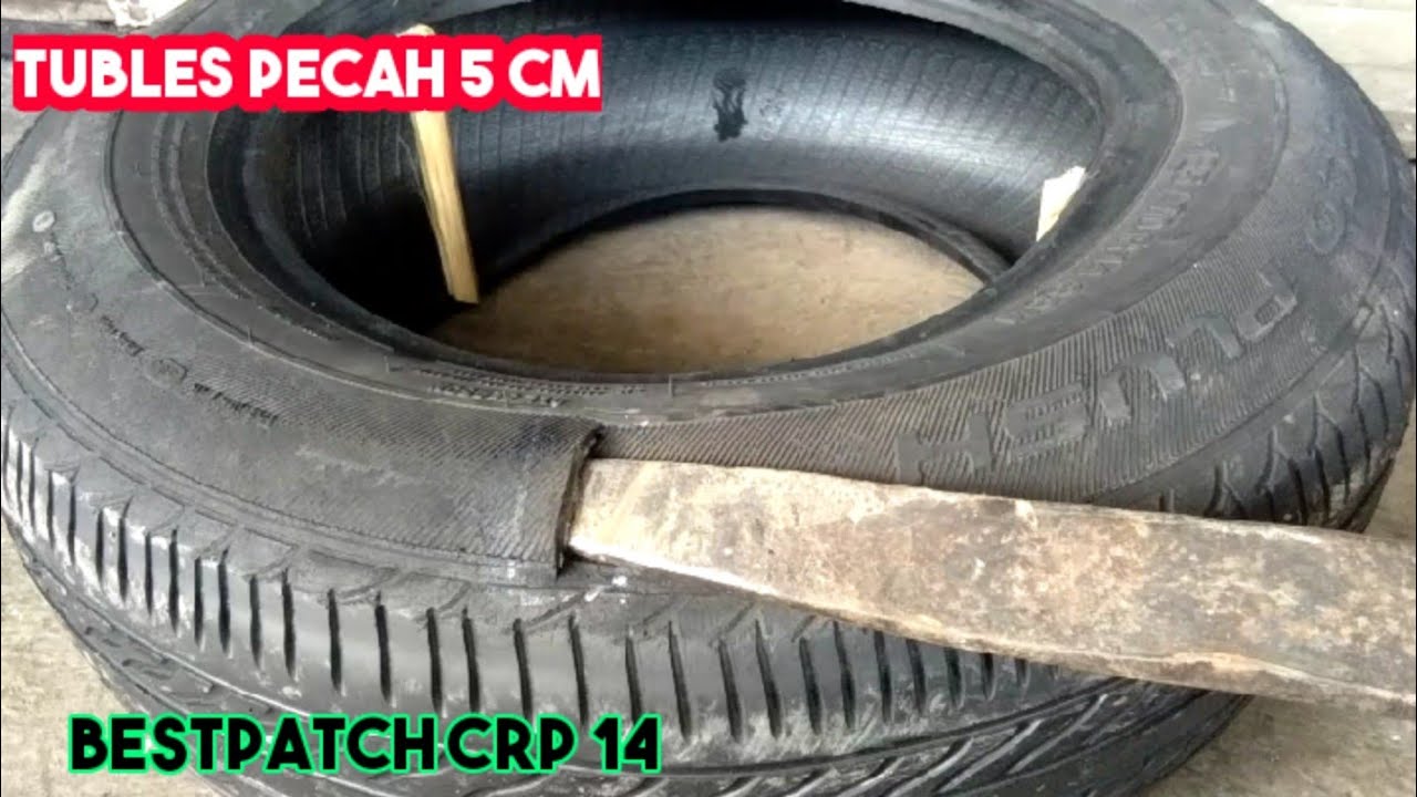 Cara Mengatasi Bocor Samping Sampai 5 cm