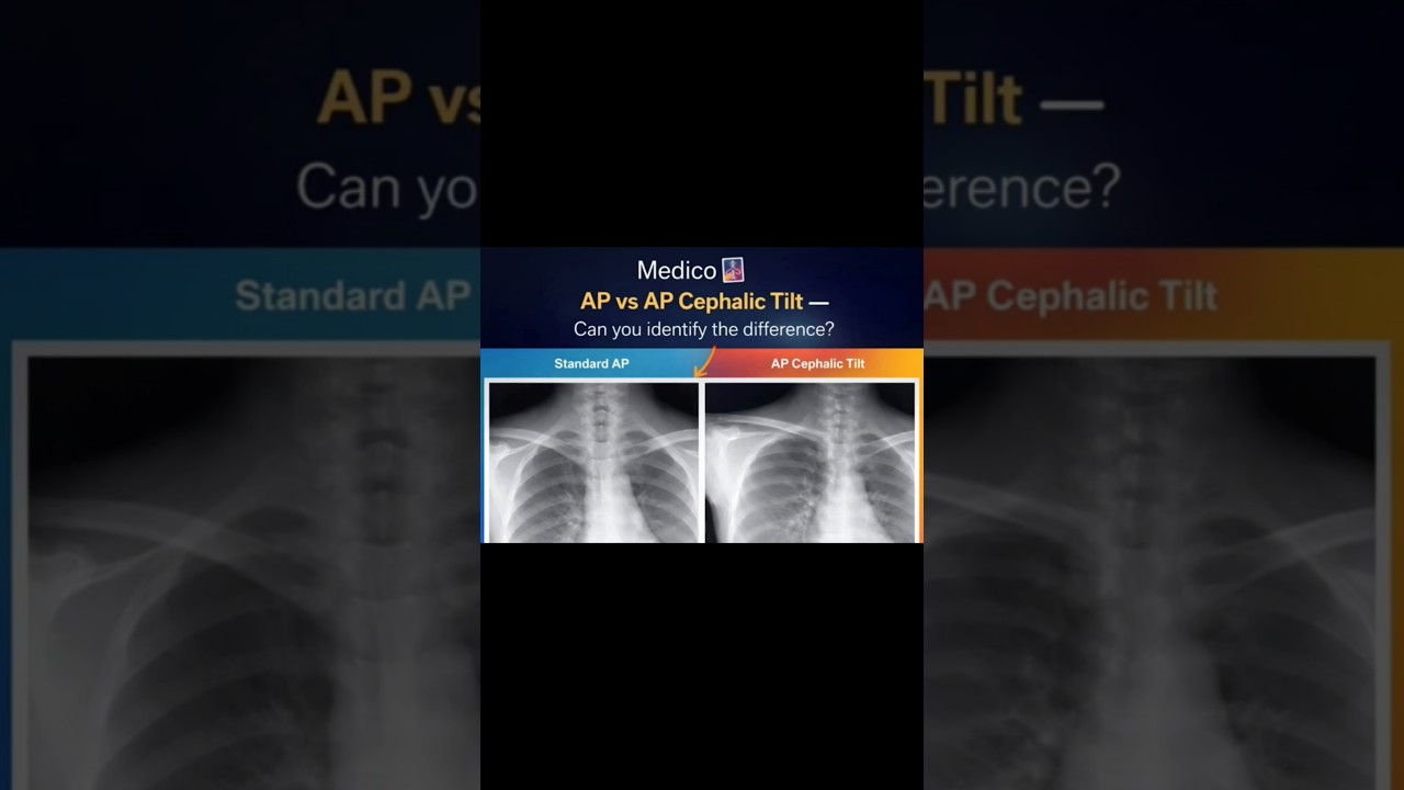 x ray made easy 