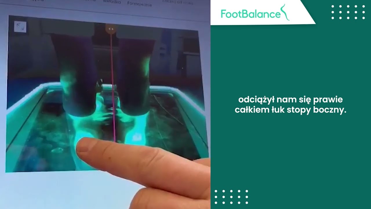 Diagnoza z badaniem stóp oraz formowanie wkladek - FootBalance Polska