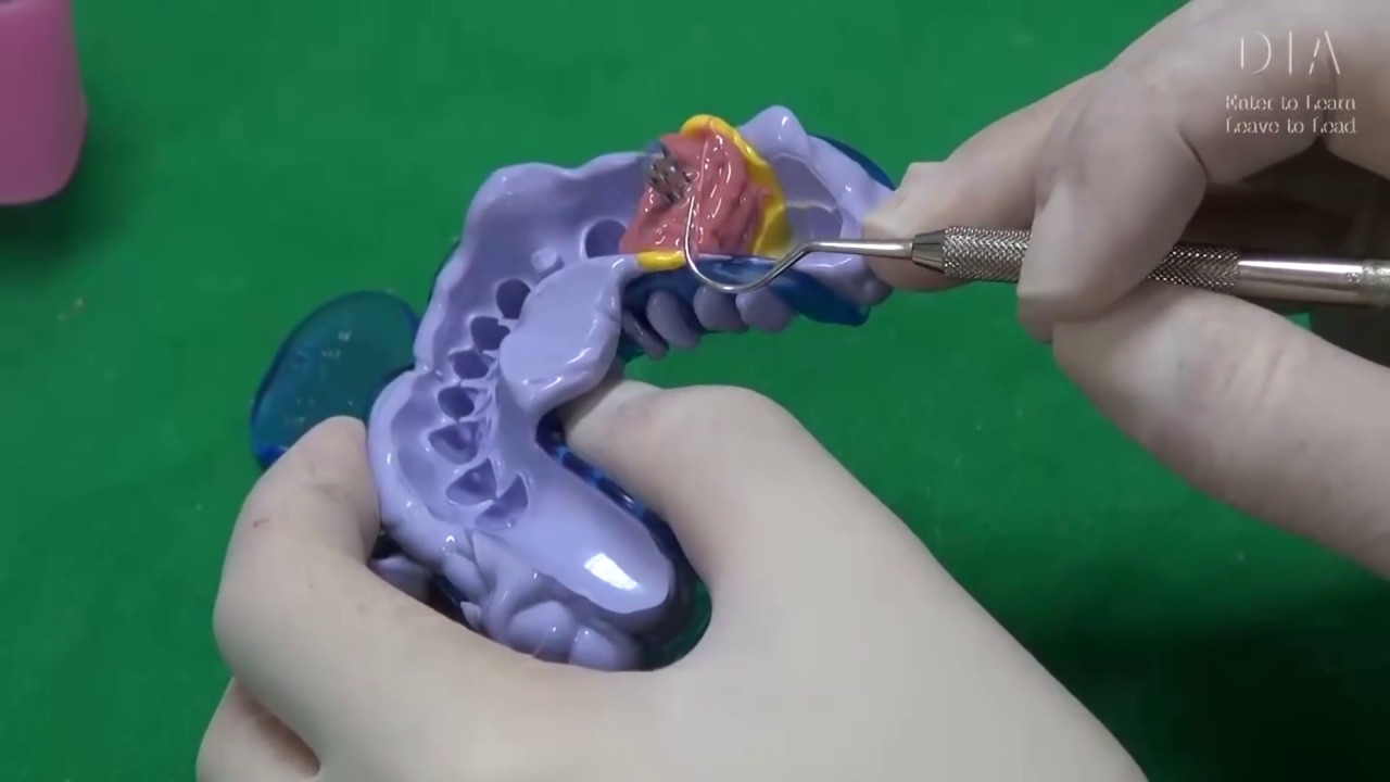 Dental Implant Prosthetic part