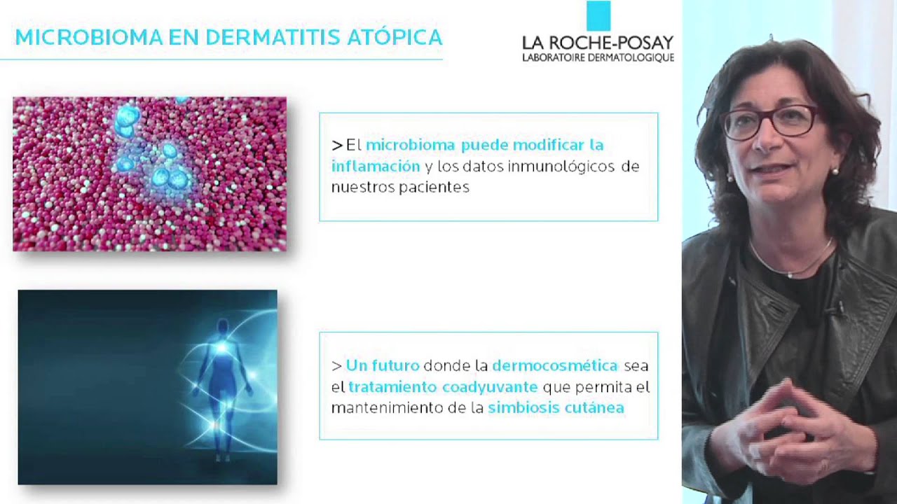 Influencia del microbioma en la dermatitis atópica