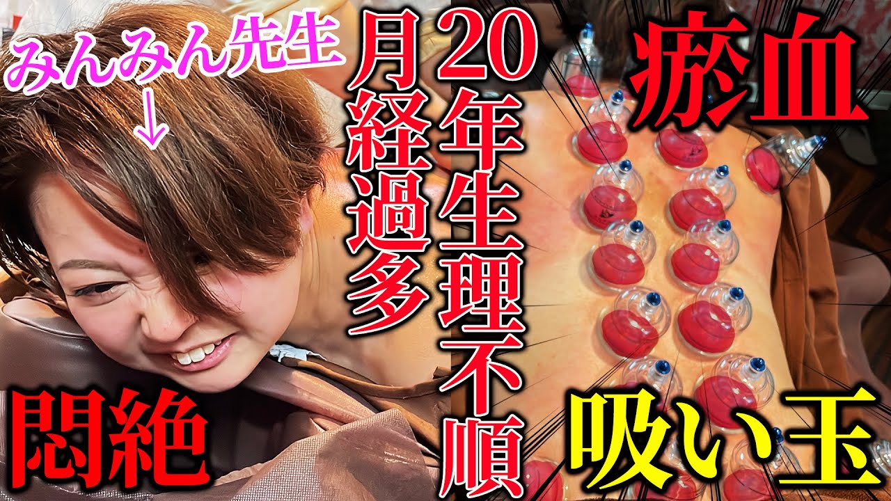 【生理　鍼灸治療】小学生から続く生理不順、月経過多、瘀血ドロドロは全身調整と吸い玉、鍼治療で治す【東京銀座　横浜元町　鍼灸院】@みんみん先生 みんみん先生