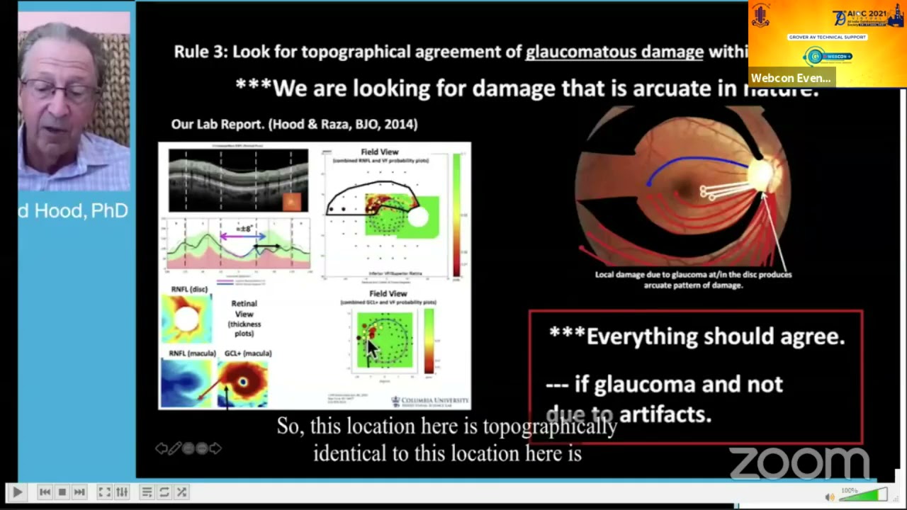 AIOC2021- GP222 - TOPIC - Dr.Donald Hood, PhD -  An OCT approach to Understanding and Detecting