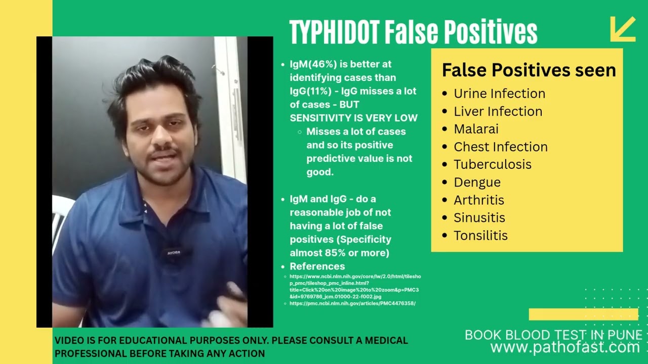 Typhidot Test for Typhoid Fever - Procedure, Normal Range, Accuracy | Typhidot Test False Positive