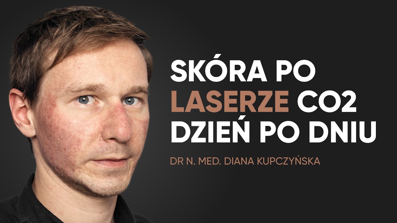 Laser CO2 na blizny - rekonwalescencja dzień po dniu