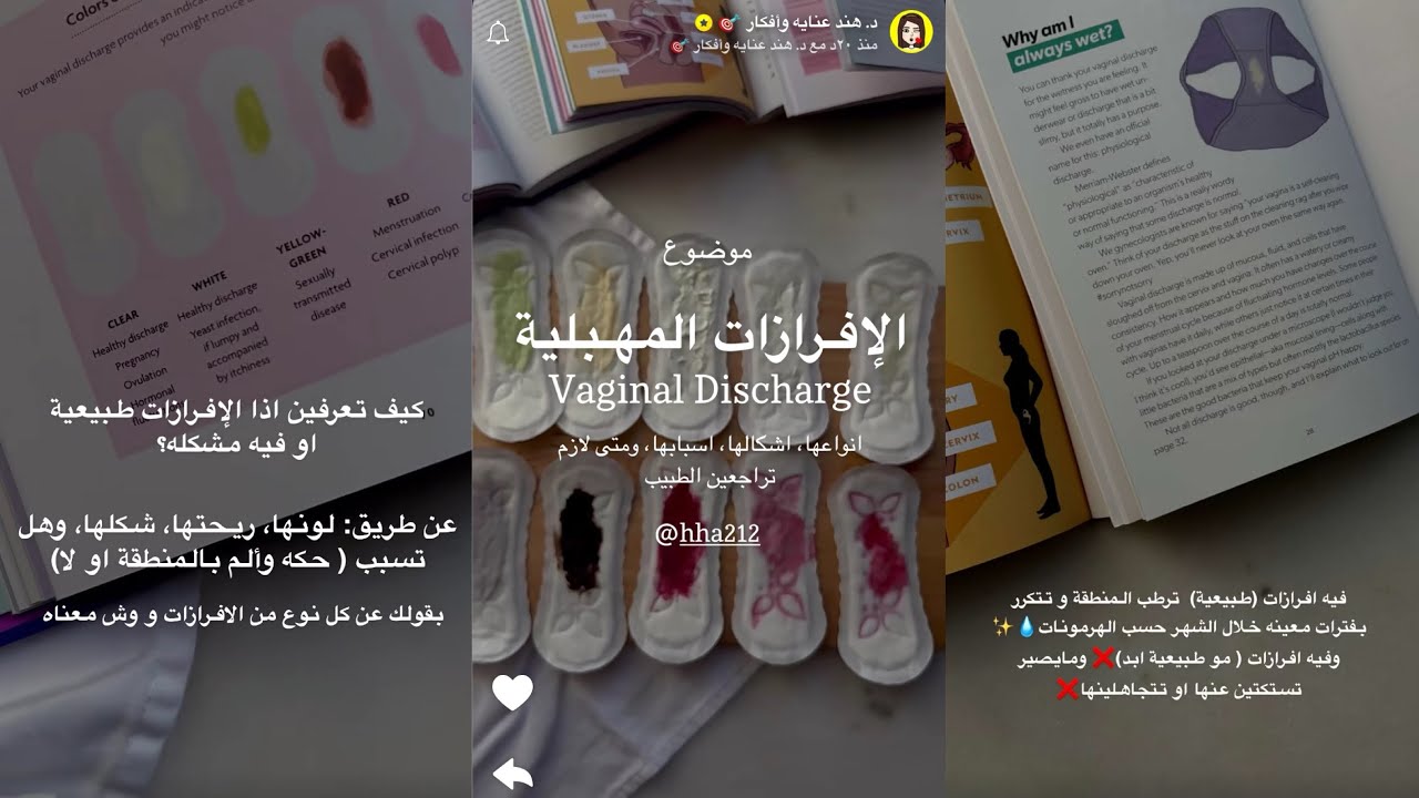 موضوع الإفرازات المهبلية أنواعها،أشكالها،أسبابها،ومتى لازم تراجعين الطبيب | د.هند عنايه وأفكار 🎯