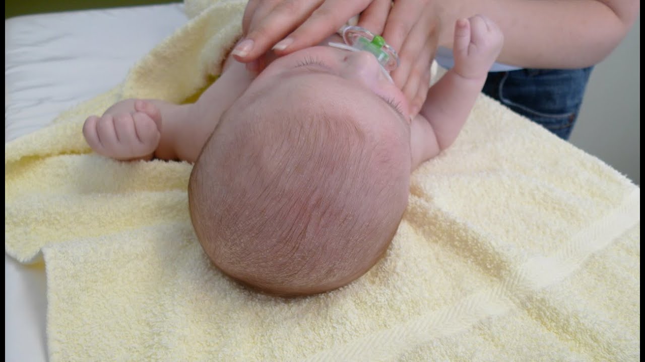 Einseitige  Kopflagerung,  Lieblingsseite und schiefe Kopfhaltung bei Babys.