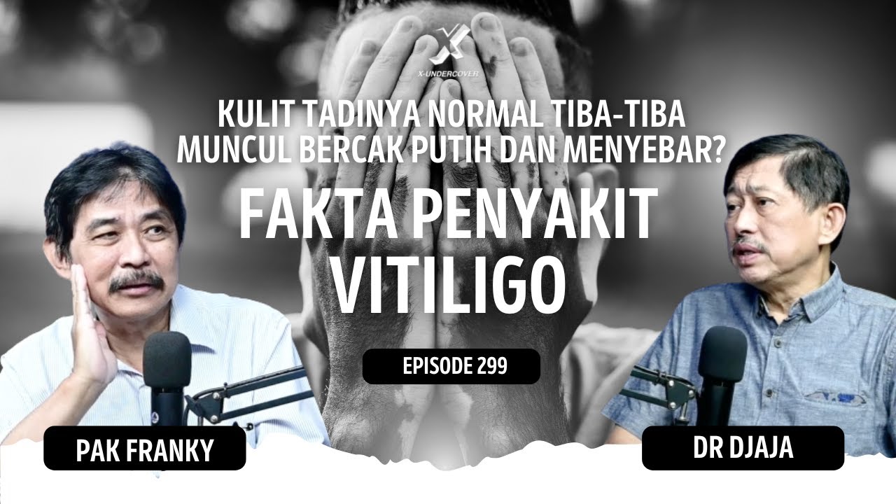 Episode 299 | Jangan Anti Dengan Penderita Vitiligo #dokterdjaja
