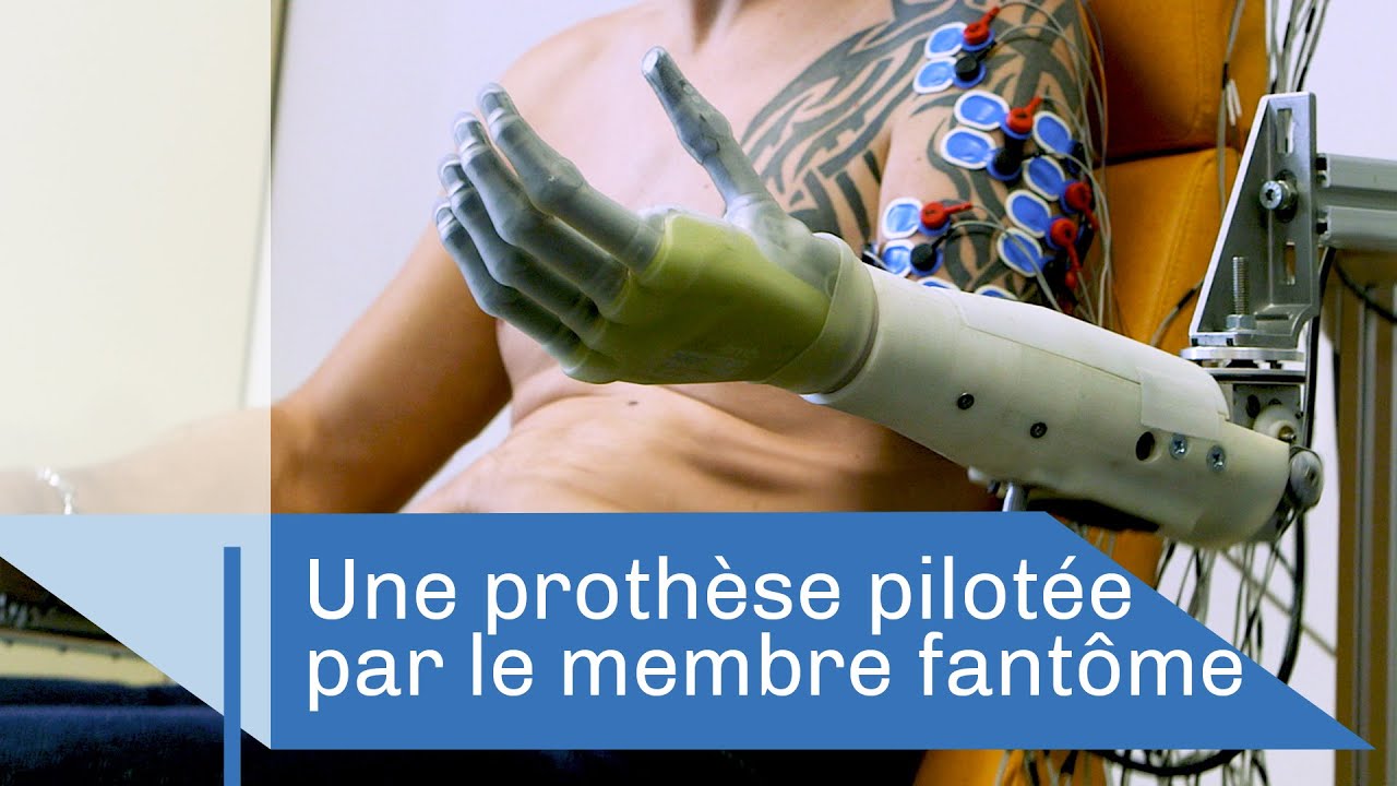 Quand le membre fantôme pilote une prothèse | Reportage CNRS