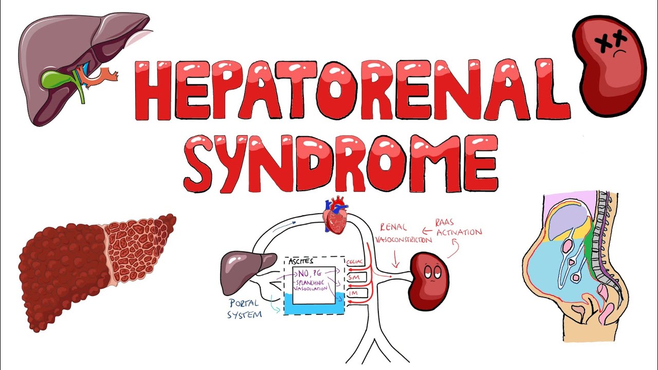 Hepatorenal Syndrome Pathophysiology - What is the mechanism of Hepatorenal Syndrome?