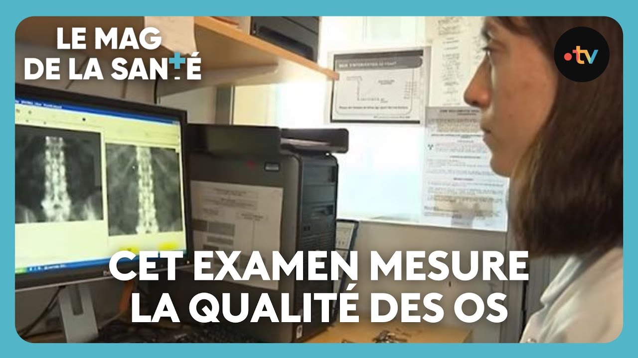 Ostéoporose : les signes d'alerte