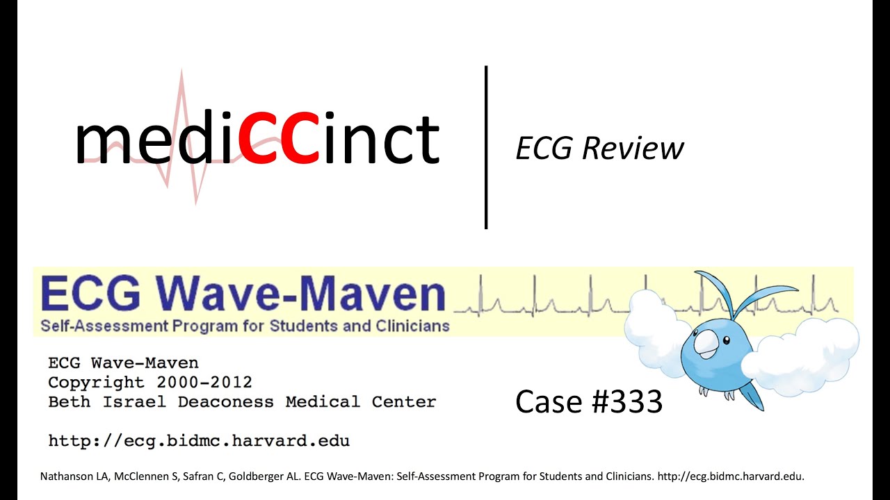COPD, Delayed R Wave Progression (ECG Wave-Maven) Case #333
