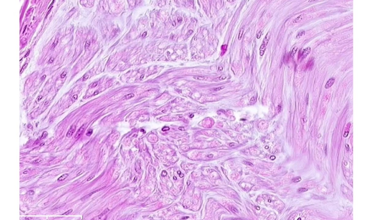 Histology of a Nerve
