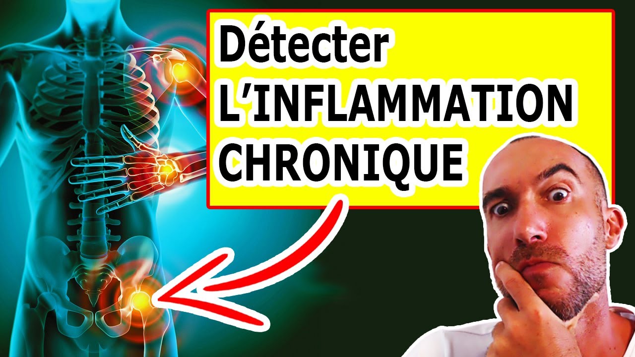 INFLAMMATION CHRONIQUE : 7 SYMPT&Ocirc;MES Qui Montrent Que VOUS &Ecirc;tes Concern&eacute; (+ LA SOLUTION)