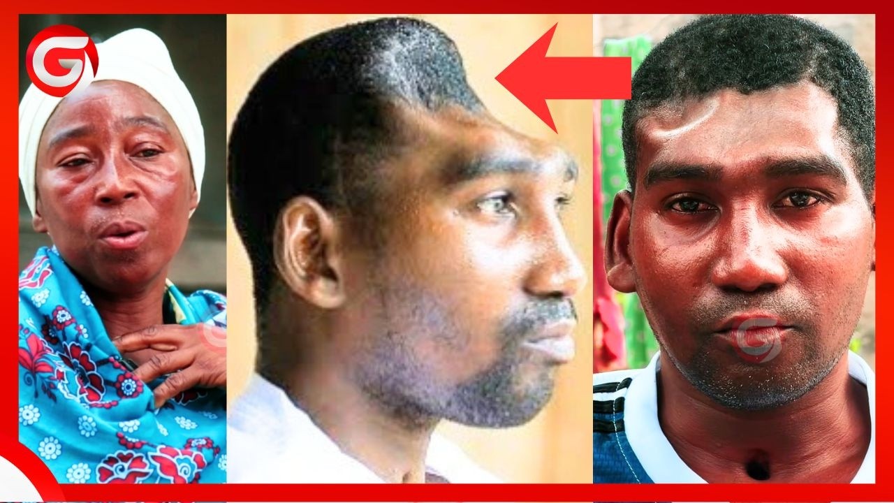 HUSSEIN ANAYEISHI BILA FUVU AANZA KUIMARIKA - ANAVAA PEMPASI - ATAKIWA KUWEKWA CEMENT KICHWANI...