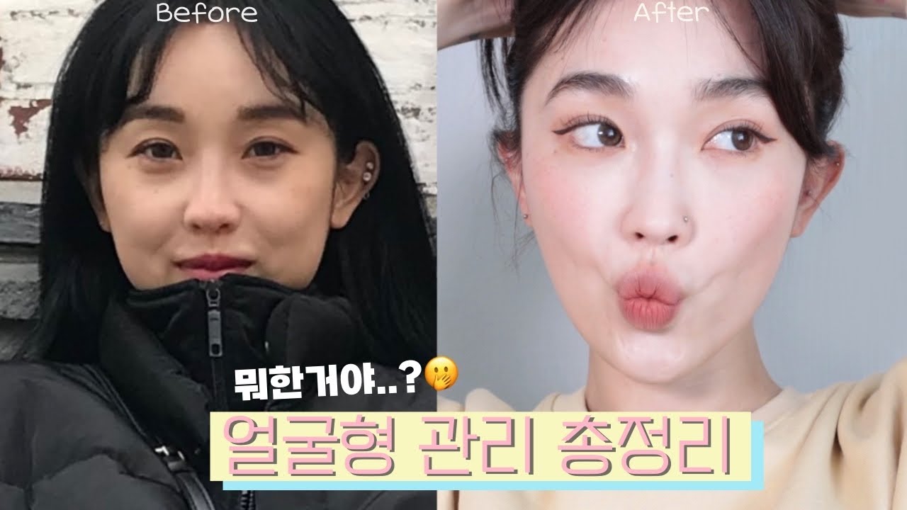 도대체 뭐 한거야?🤭수술X 10년째 얼굴형 관리중 (각종 시술들 추천or비추, 홈케어,비대칭 교정운동, 뮤잉..)