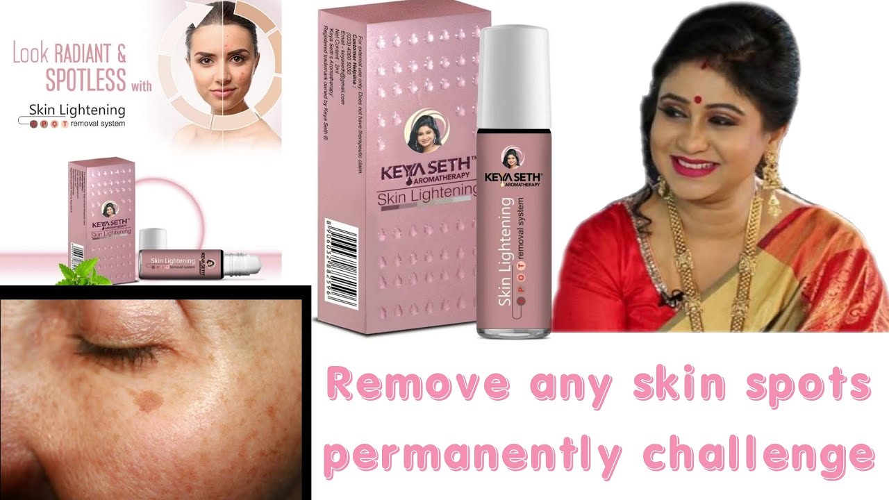 || Keya Seth Skin Lightening Lotion || Acne & Dark Spot Removing Lotion || Honest Review ||
