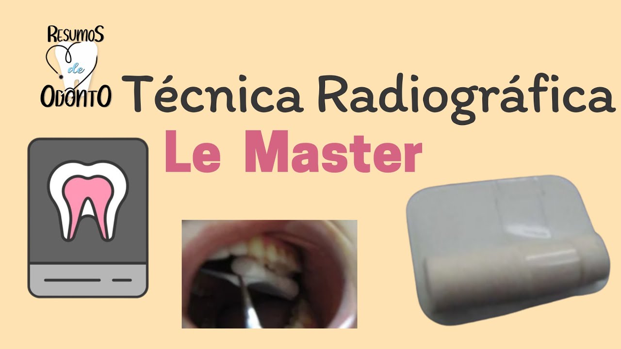Le Master - Método de Localização Radiográfica