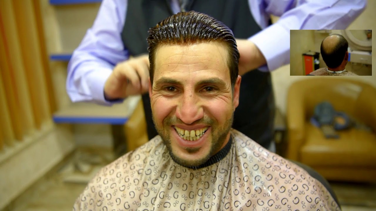تركيب شعر طبيعي 100% للرجال والسيدات 079 99 55 0 66 عمان - جبل الحسين