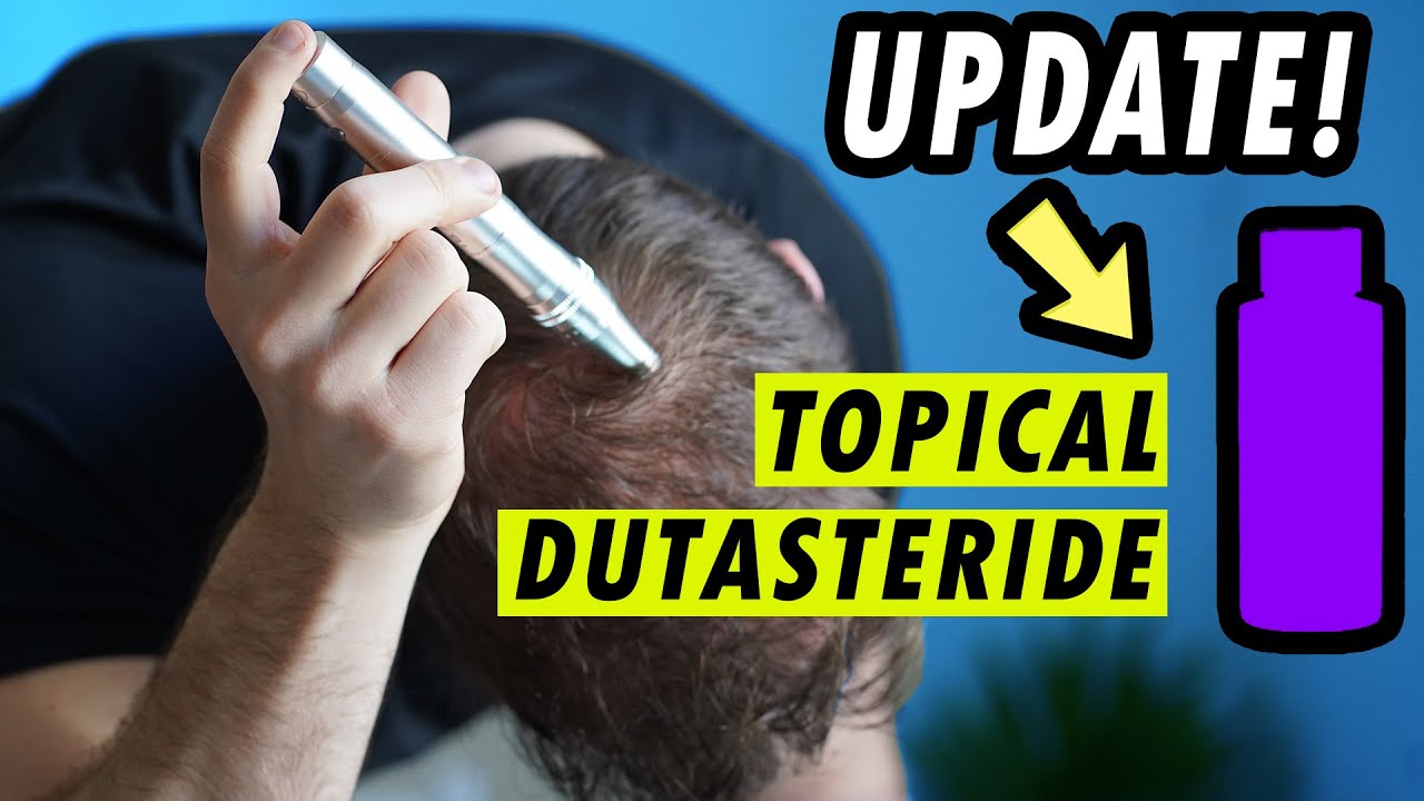 My Microneedling Regimen UPDATE! Topical Dutasteride
