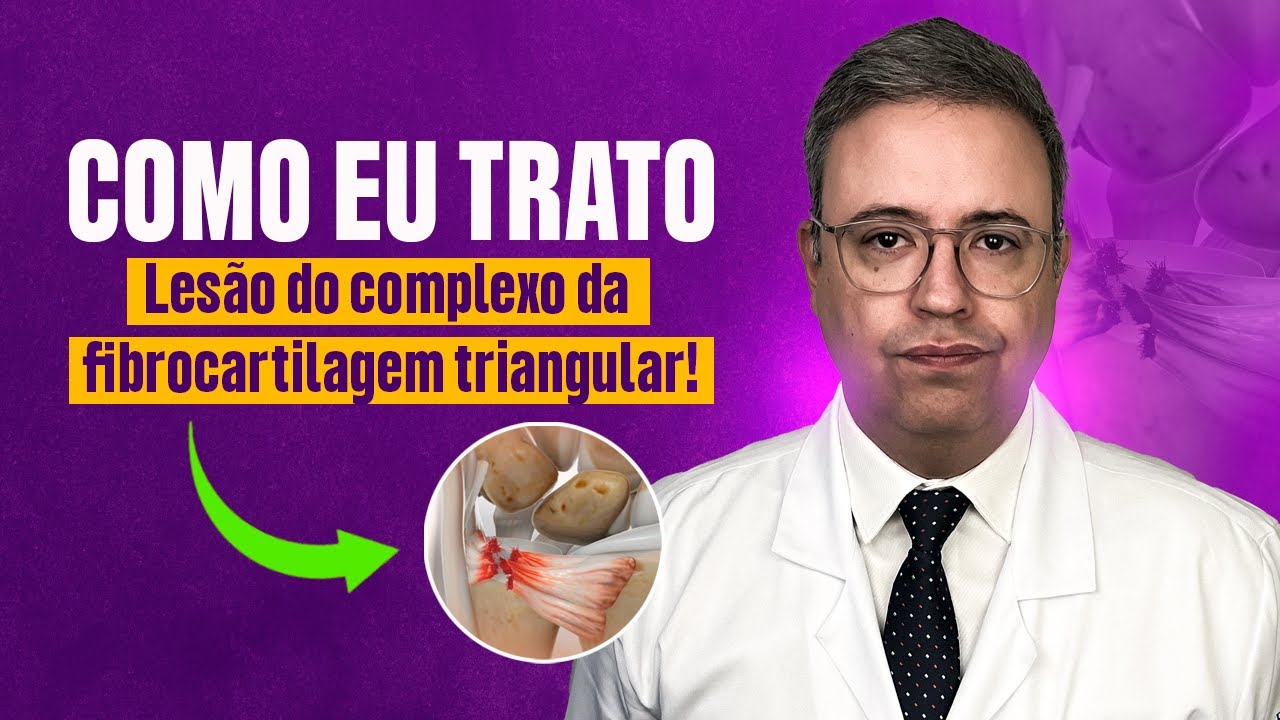 Lesão do complexo da fibrocartilagem triangular: como eu trato!