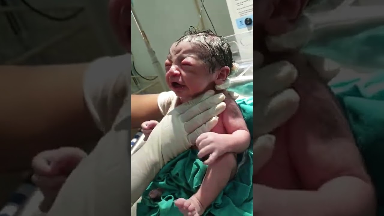 cord claimb cut newborn baby cry for watching @aradhnavermanursingwork9453 ❤