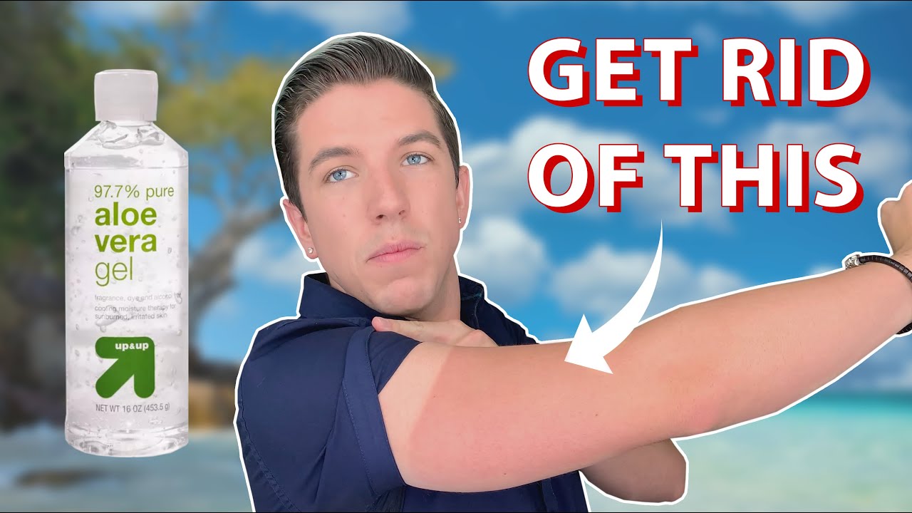 How to Get Rid of a Sunburn FAST