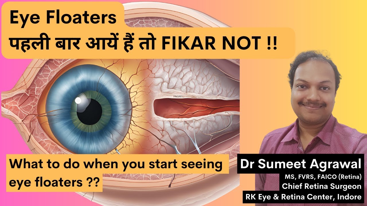Eye Floaters से घबराएं नहीं !! यह TIPS FOLLOW करें.