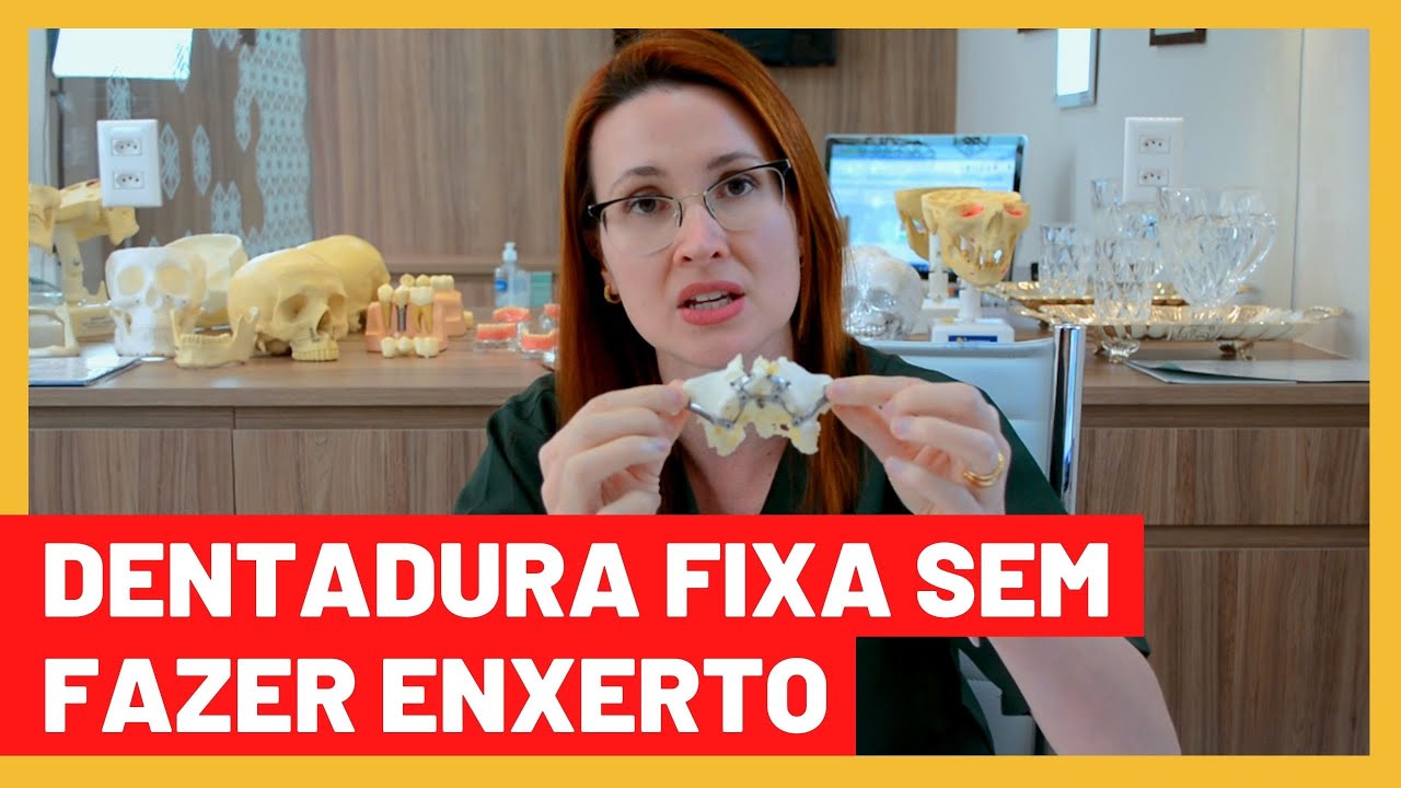 Implante Dentário sem Exerto l Dra. Danielle Sales