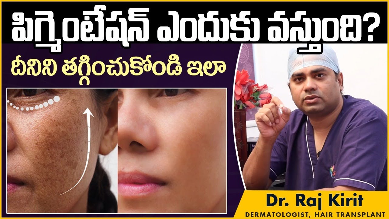 పిగ్మెంటేషన్ తగ్గాలంటే| Causes Of Pigmentation Telugu | Dr Raj Kirit | Celestee Skin And Hair Clinic