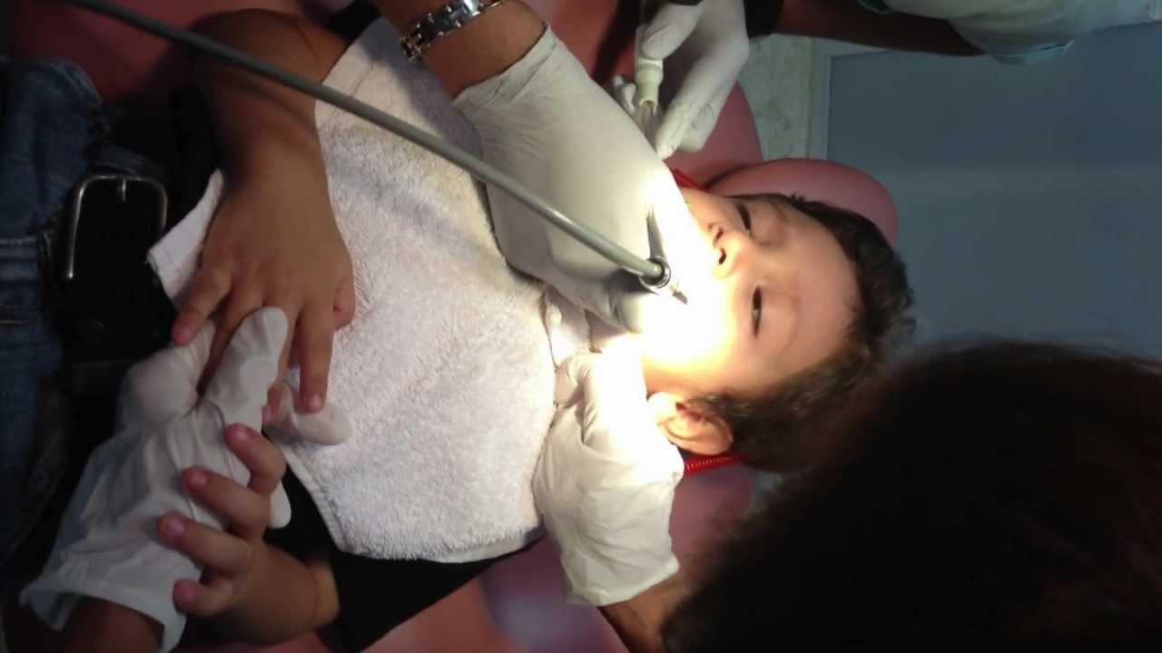 Quitando Caries a niño de 3 años