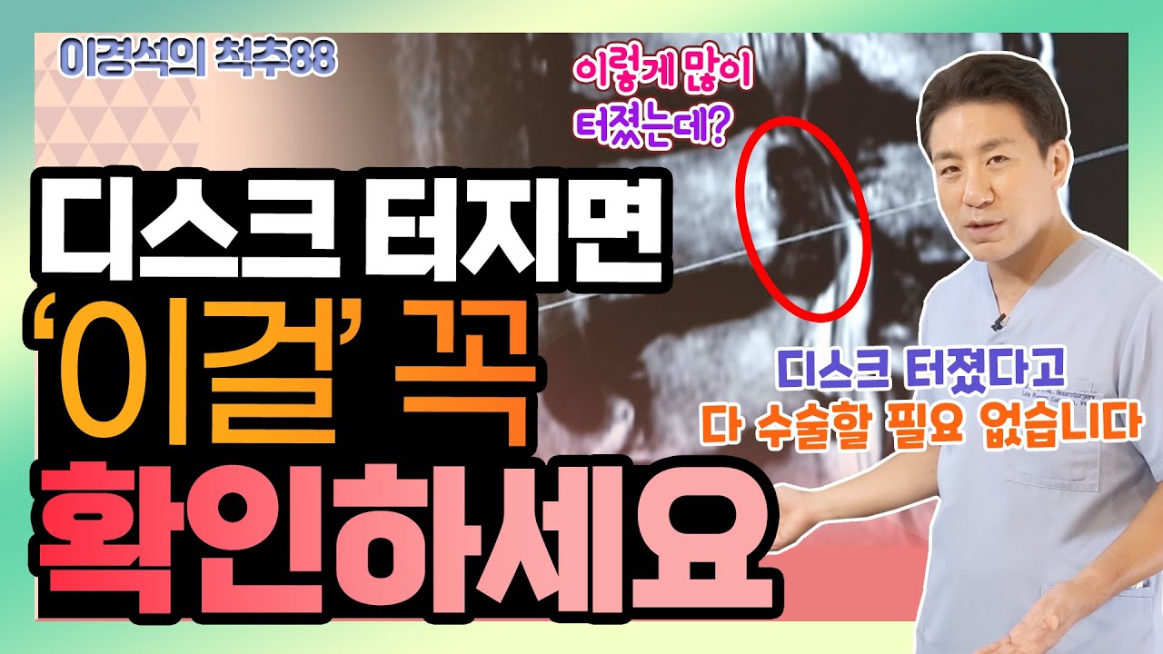 디스크 터졌다고 다 수술하는 건 아니다? - 이경석의 척추88 #98 - 디스크 파열 치료