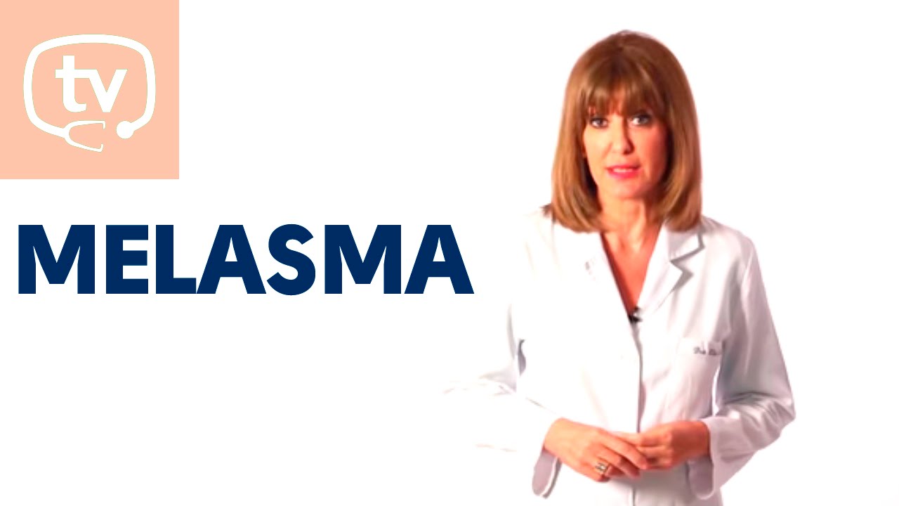¿Qué es y cómo tratar el melasma?