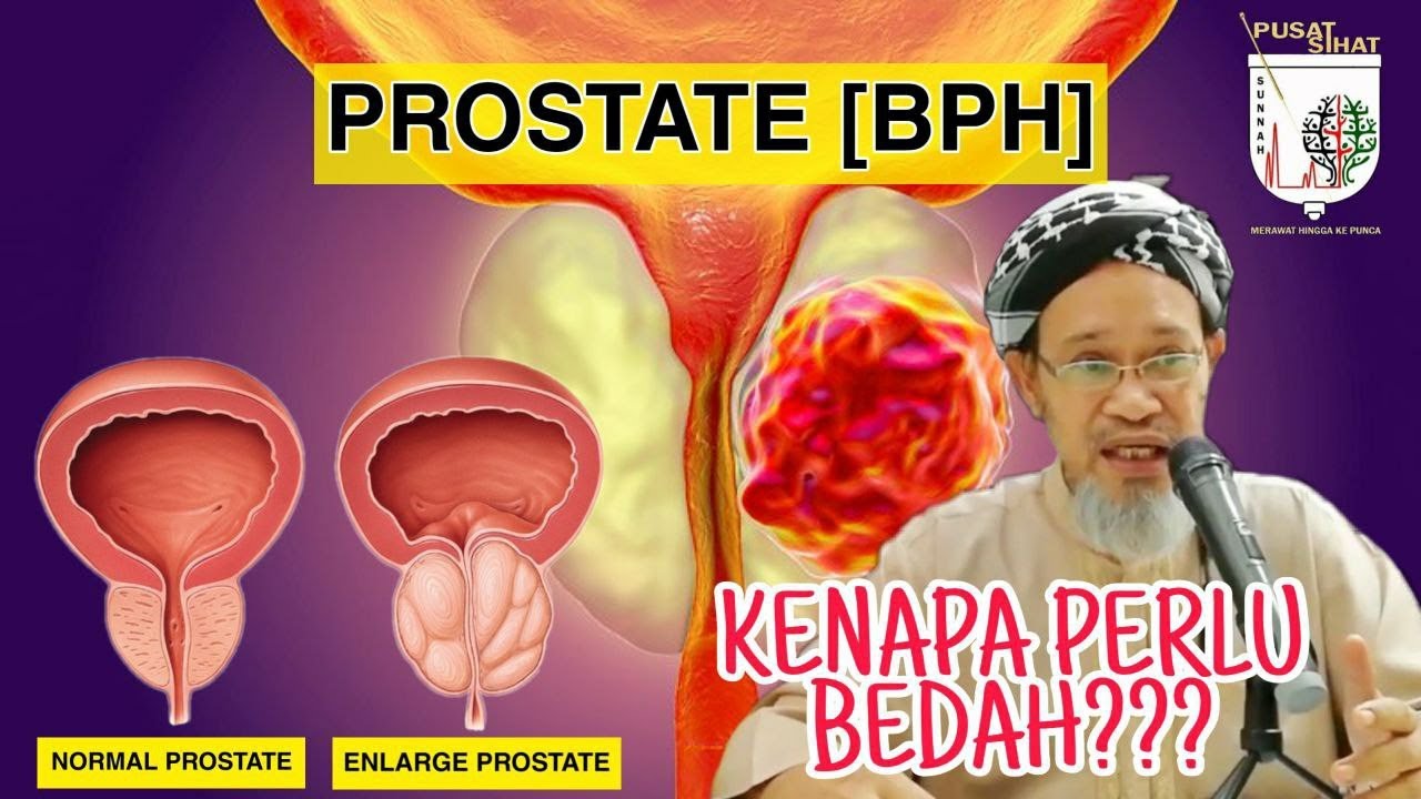Masalah PROSTAT- Untuk hidup normal - Pusat Sihat